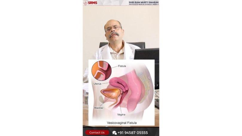 HOPE RESTORED: SRMS INSTITUTE OF MEDICAL SCIENCES TREATS COMPLEX VESICOVAGINAL FISTULA (VVF) CASES WITH SUCCESS; BRINGS HOPE TO WOMEN ACROSS UTTAR PRADESH!